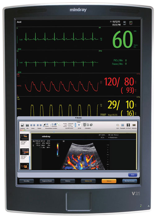 Mindray-V12-Patient-Monitors